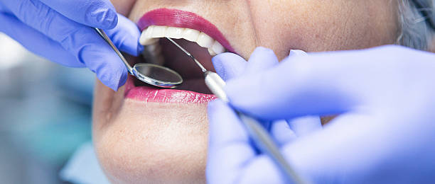 Best Emergency Dental Extractions in Union City, OK
